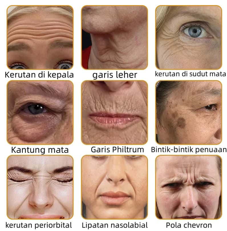 🔥Last Day Promotion 49% OFF🔥 - Krim Penghilang Kerutan Racun Lebah Botulin