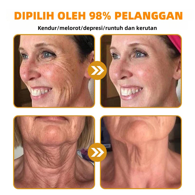 🔥Last Day Promotion 49% OFF🔥 - Krim Penghilang Kerutan Racun Lebah Botulin