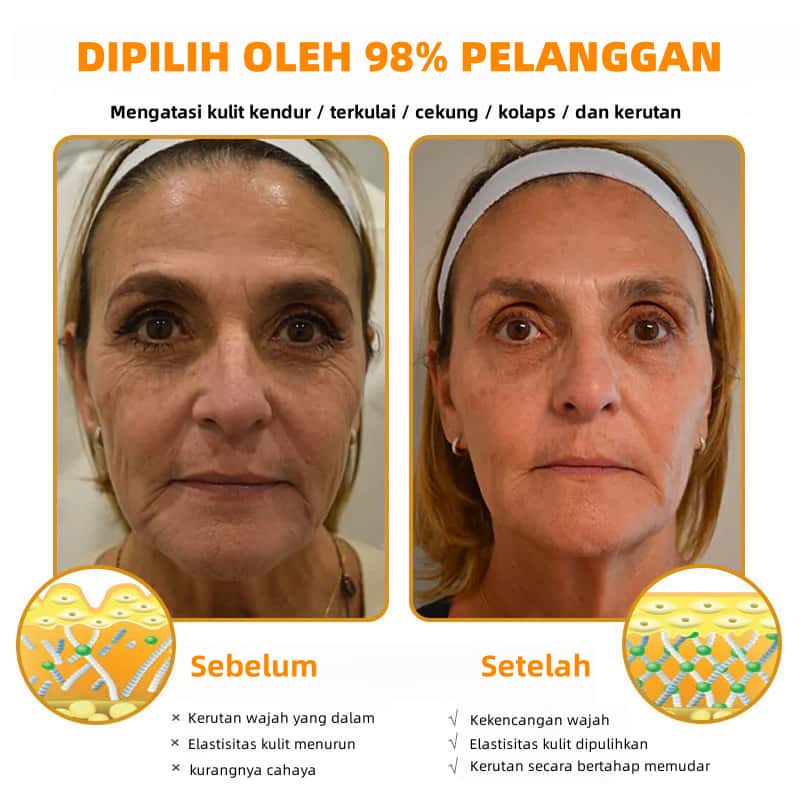 🔥Last Day Promotion 49% OFF🔥 - Krim Penghilang Kerutan Racun Lebah Botulin